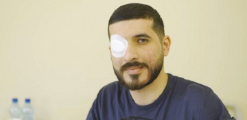 Israeli woman donates cornea of her late husband to Azerbaijani soldier (VIDEO)