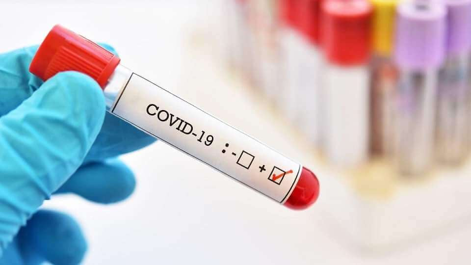 Azerbaijan logs 121 fresh coronavirus cases