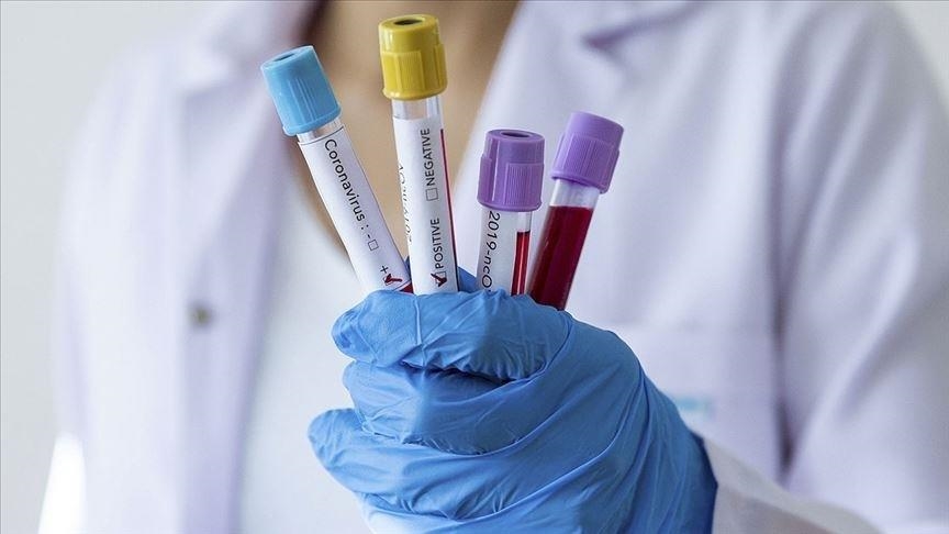 Azerbaijan registers 60 daily coronavirus cases